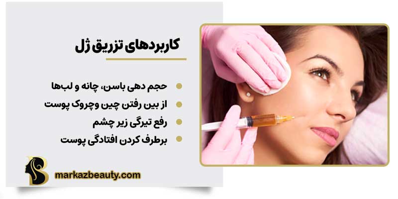 کاربردهای تزریق ژل