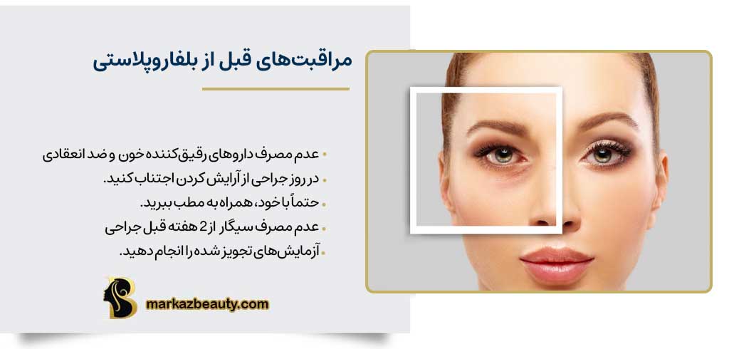 مراقبت‌های قبل از بلفاروپلاستی