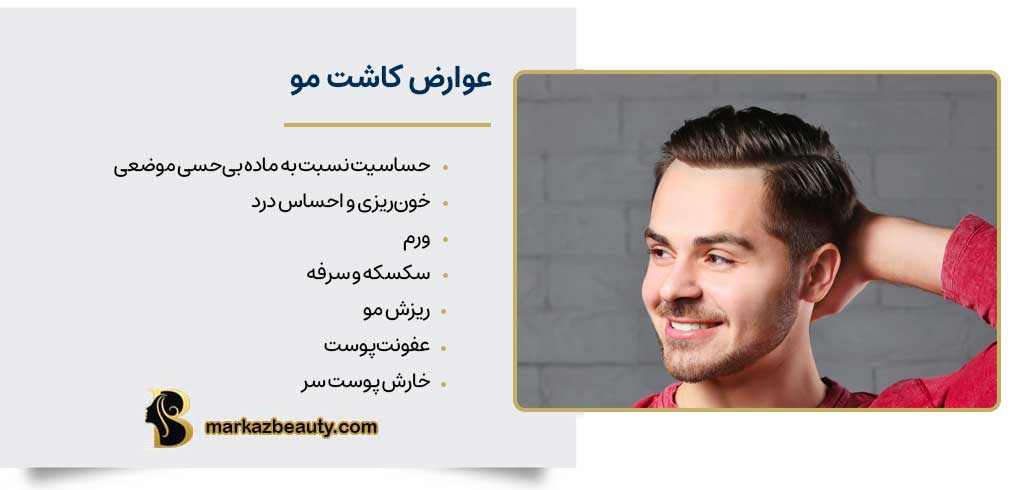 عوارض کاشت مو