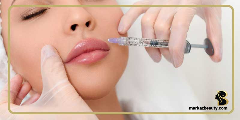 هزینه تزریق ژل در اصفهان هزینه تزریق ژل در اصفهان