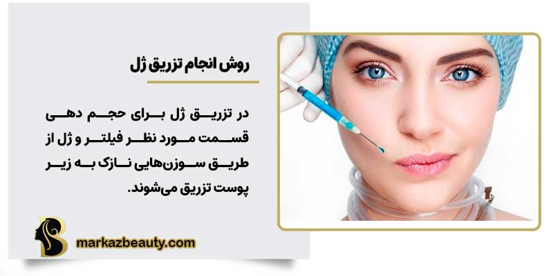 روش انجام تزریق ژل