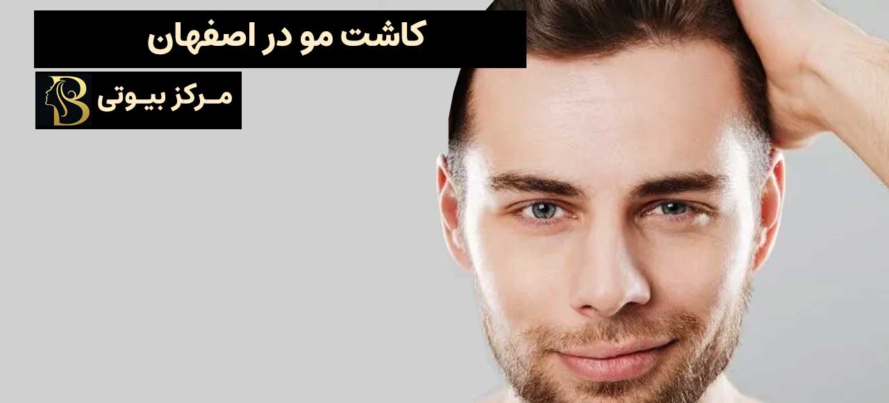 کاشت مو در اصفهان