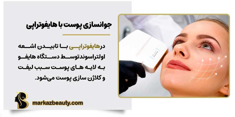 هایفوتراپی در اصفهان