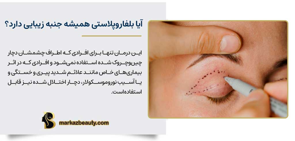 آیا بلفاروپلاستی همیشه جنبه زیبایی دارد؟