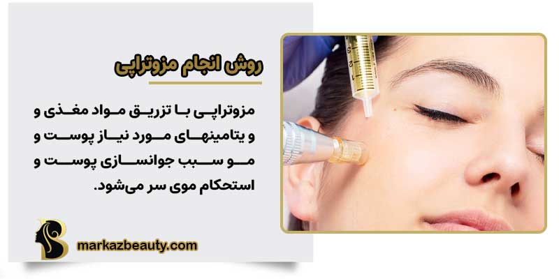روش انجام مزوتراپی