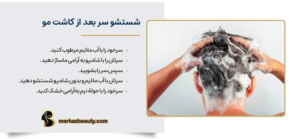 شستشو سر بعد از کاشت مو