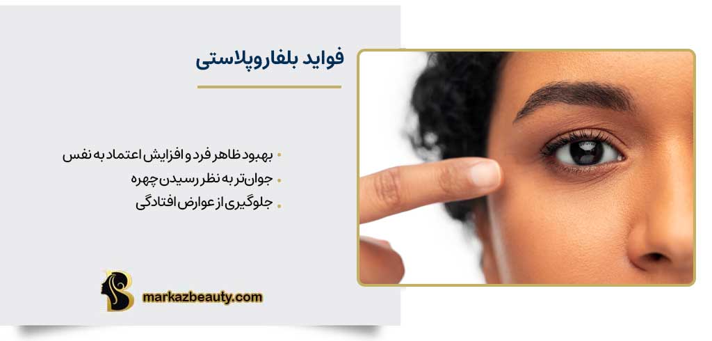 بلفاروپلاستی یا جراحی پلک چه فوایدی دارد؟