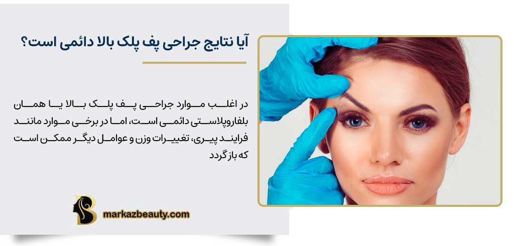 آیا نتایج جراحی پف پلک بالا دائمی خواهد بود؟