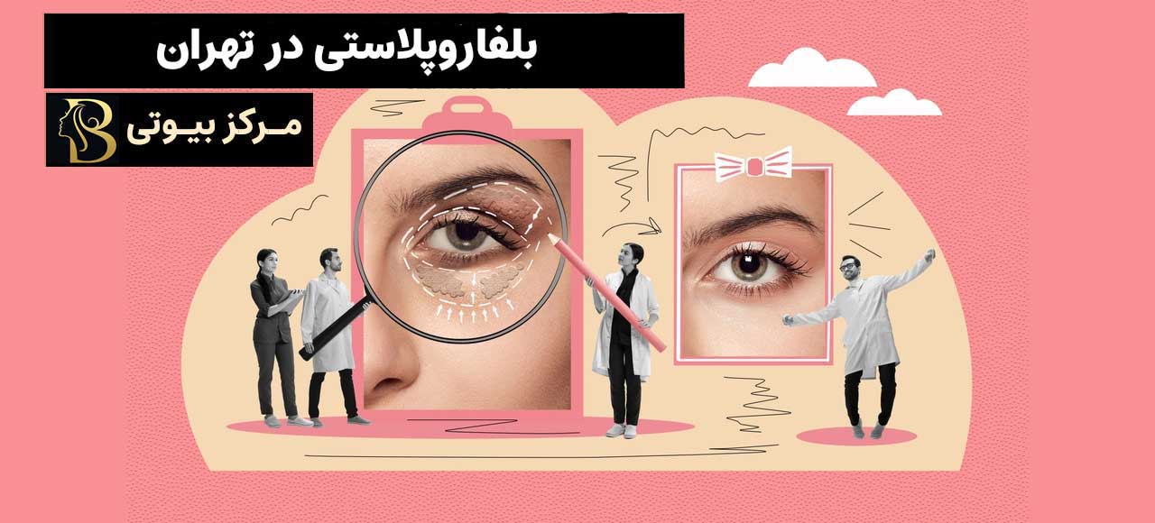 بلفاروپلاستی در تهران
