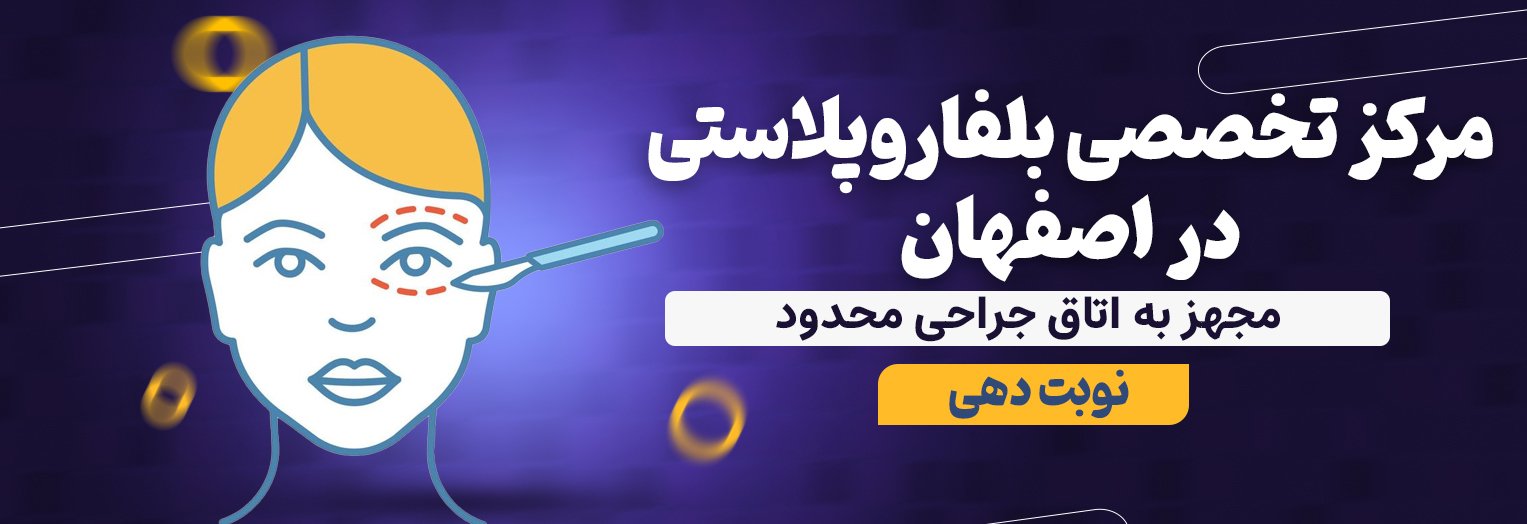 جراحی پلک یا بلفاروپلاستی در اصفهان 