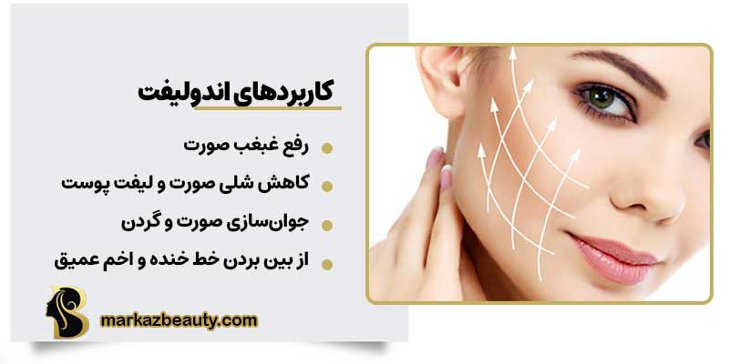 کاربردهای اندولیفت