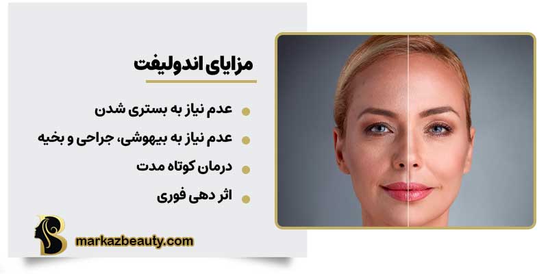 مزایای اندولیفت