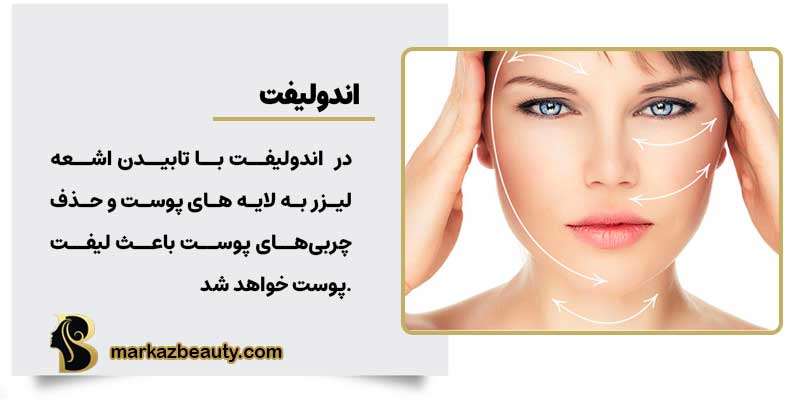 اندولیفت و جوانسازی پوست