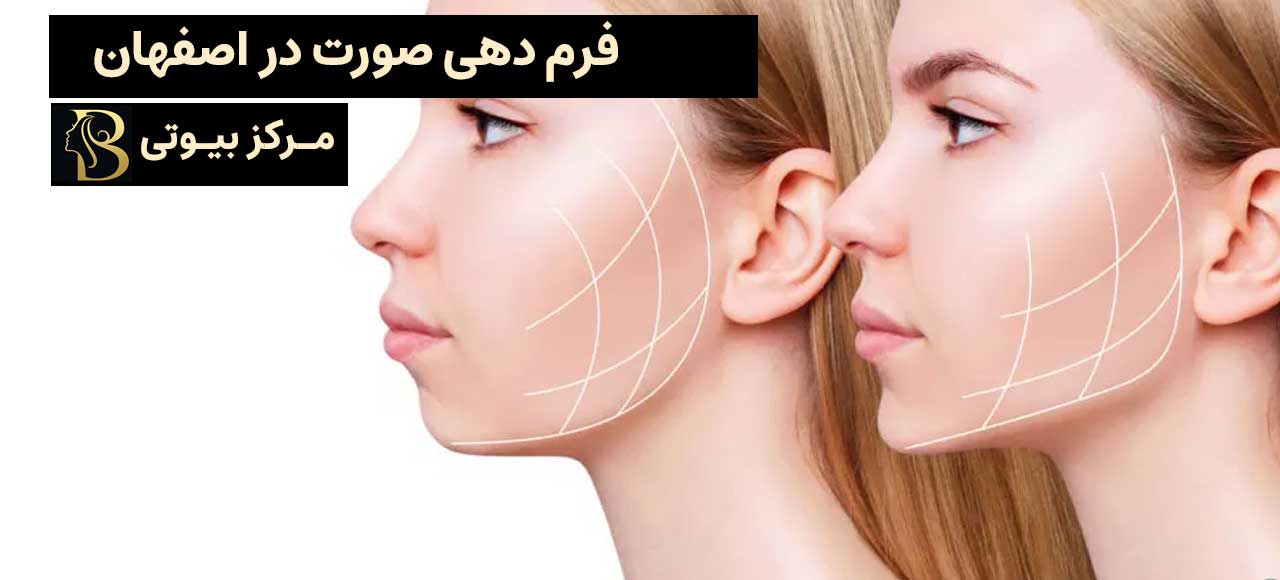فرم دهی صورت در اصفهان