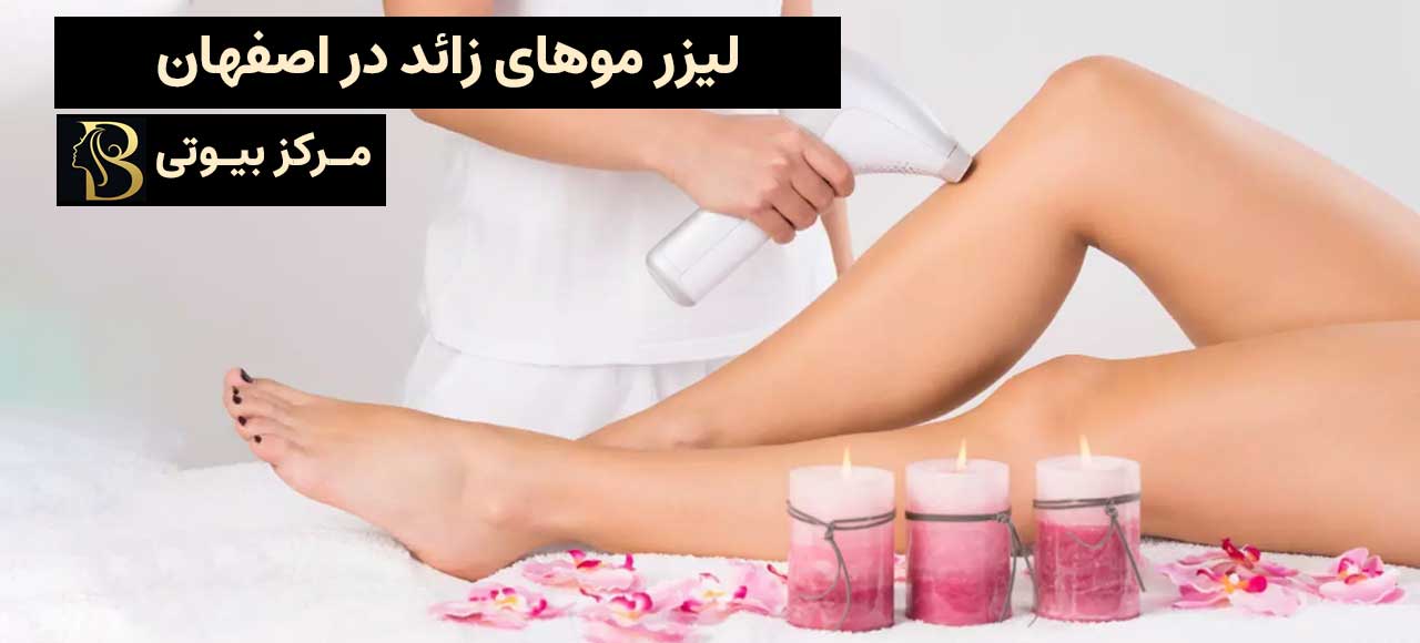 لیزر موهای زائد در اصفهان