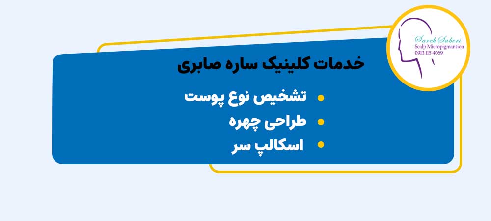 متخصص اسکالپ سر اصفهان ساره صابری