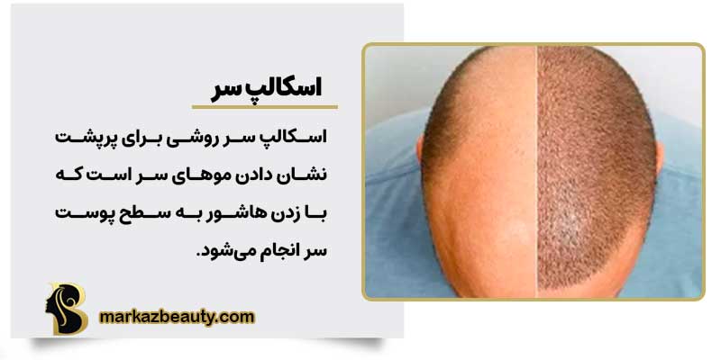اسکالپ سر اصفهان