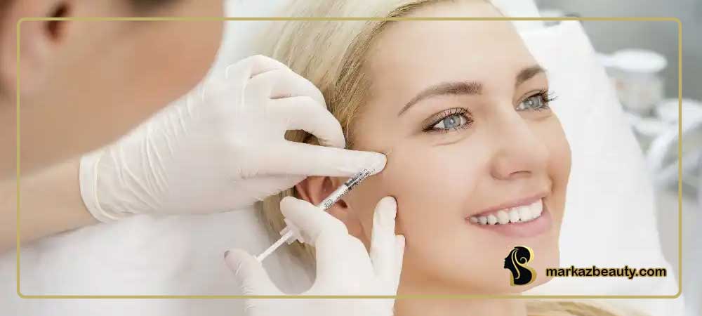 تزریق ژل اقساطی