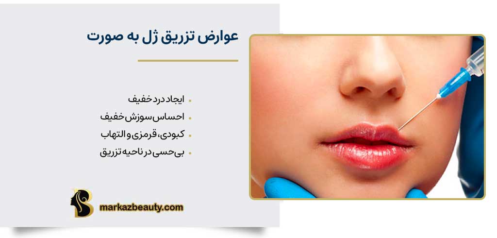 عوارض تزریق ژل به صورت