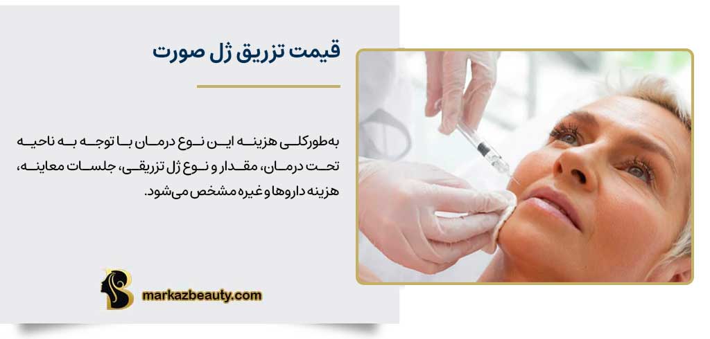 قیمت تزریق ژل صورت