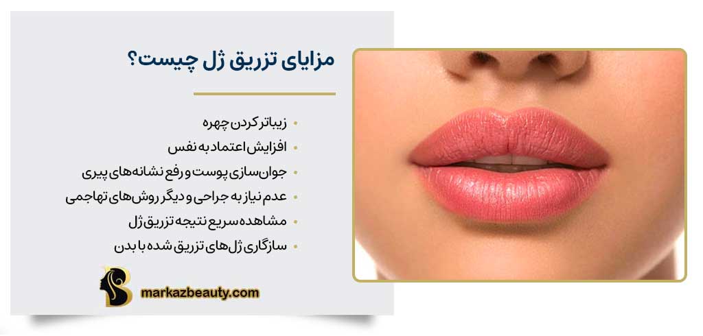 مزایای تزریق ژل چیست؟