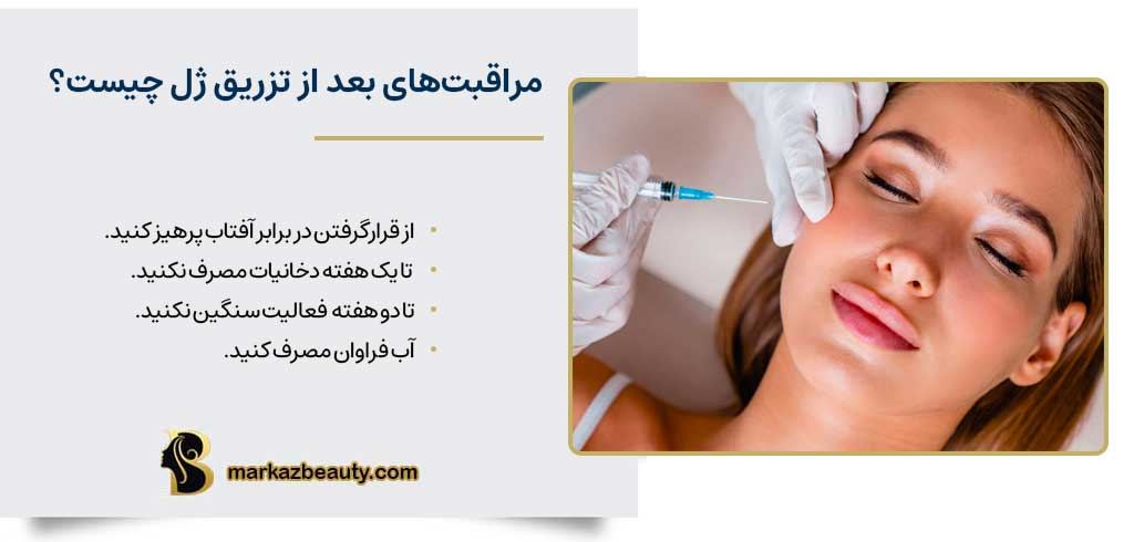 مراقبتهای بعد از تزریق ژل چیست؟
