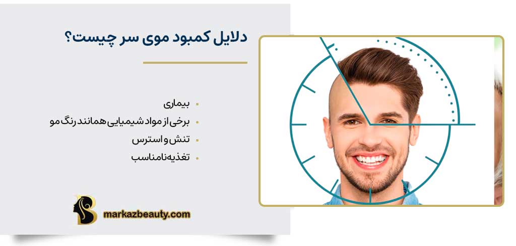 دلایل کمبود موی سر چیست؟