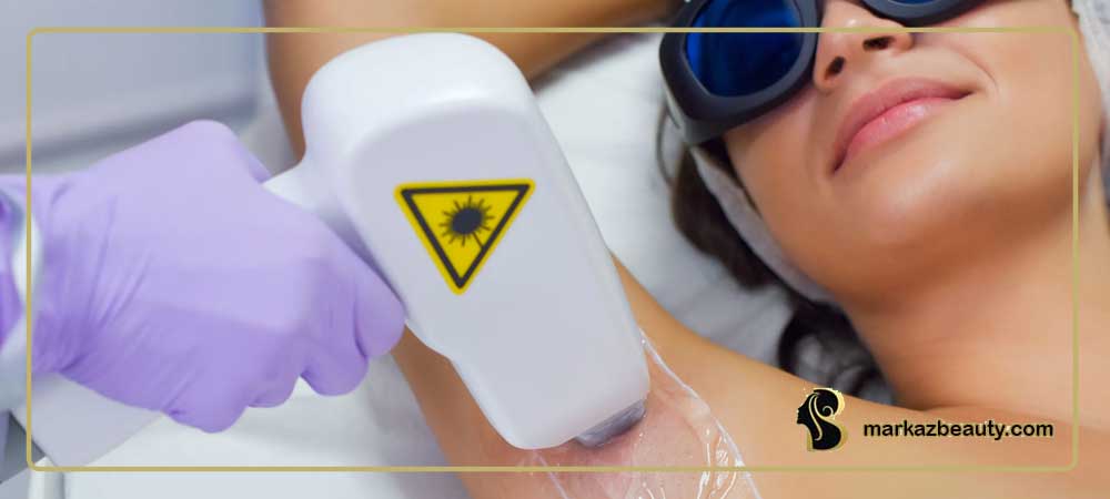 لیزر موهای زائد (Laser Hair Removal) چیست؟