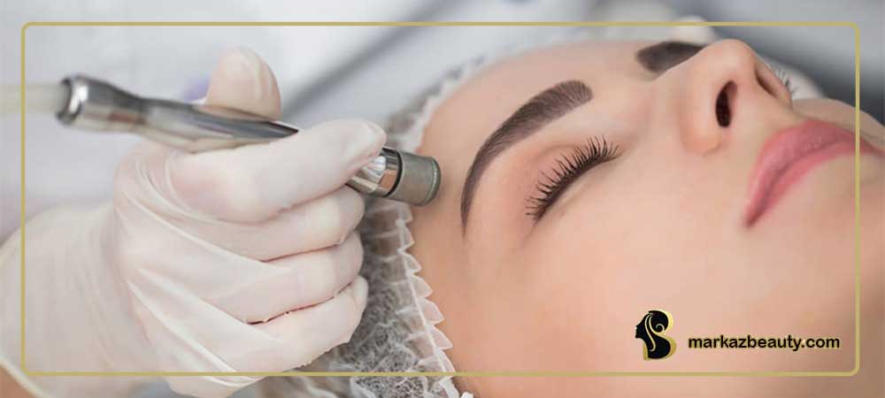 هزینه میکرودرم در اصفهان