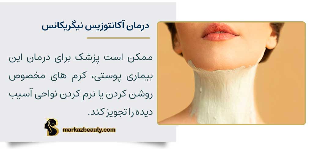 درمان آکانتوزیس نیگریکانس