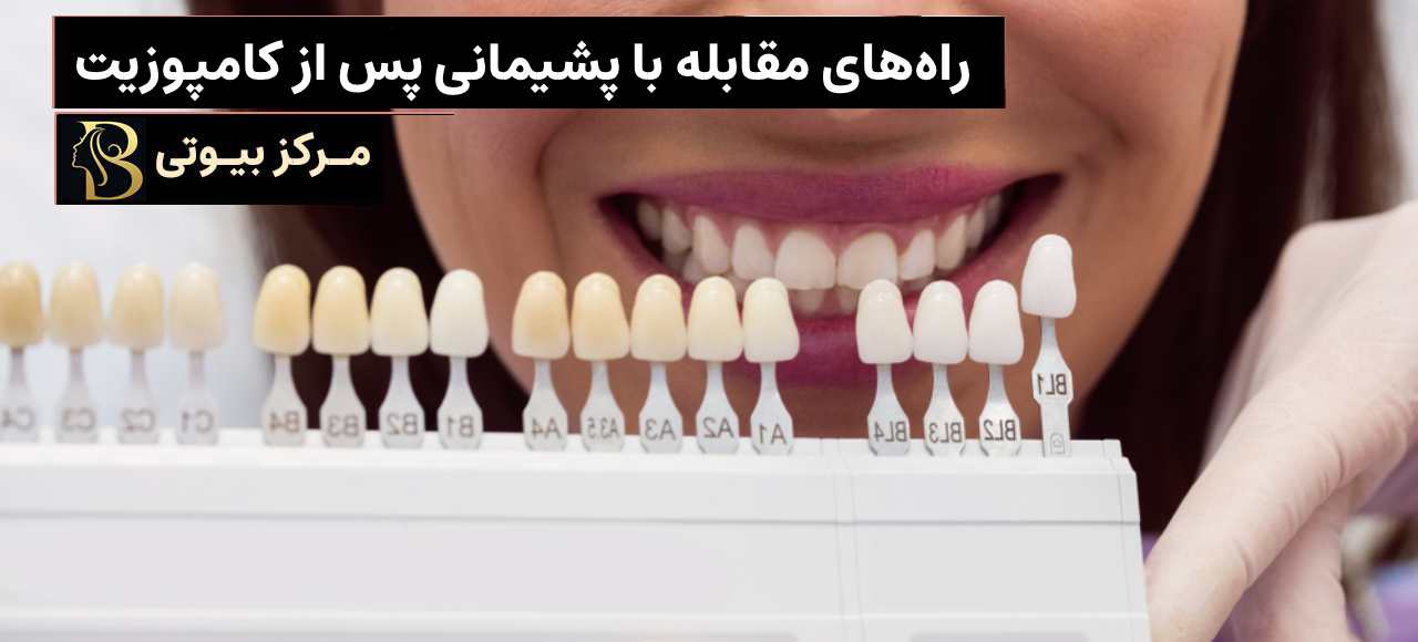 راه هایی برای مقابله با پشیمانی پس از کامپوزیت