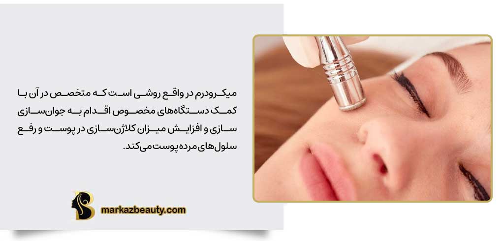 میکرودرم چیست؟