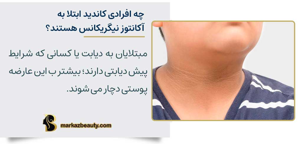 چه افرادی بیشتر در معرض خطر ابتلا به آکانتوز نیگریکانس قرار می گیرند؟