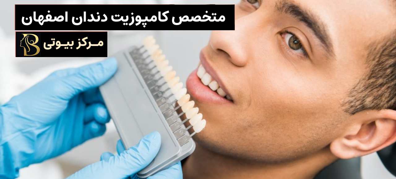 متخصص ونیر کامپوزیت اصفهان