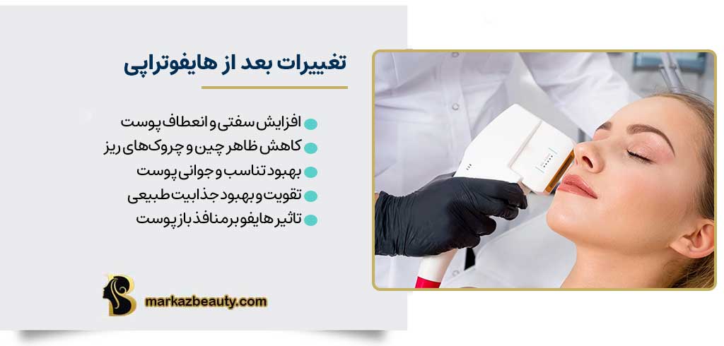 هایفوتراپی موجب چه تغییراتی می شود؟ | مرکز بیوتی