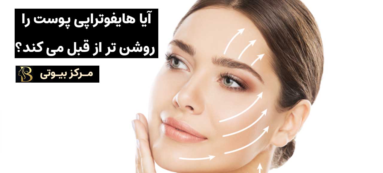 آیا هیپوتراپی پوست را روشن تر از قبل می کند؟ | مرکز بیوتی