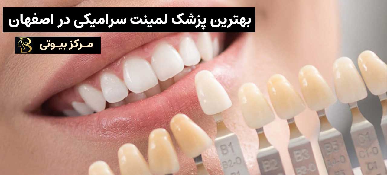 بهترین دکتر لمینت دندان در اصفهان