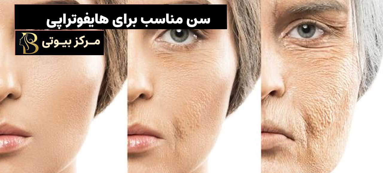 سن مناسب برای هایفوتراپی