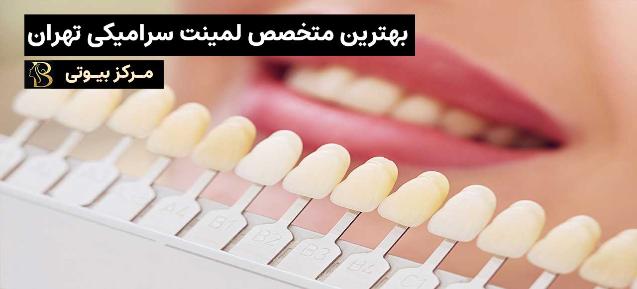بهترین پزشک لمینت در تهران