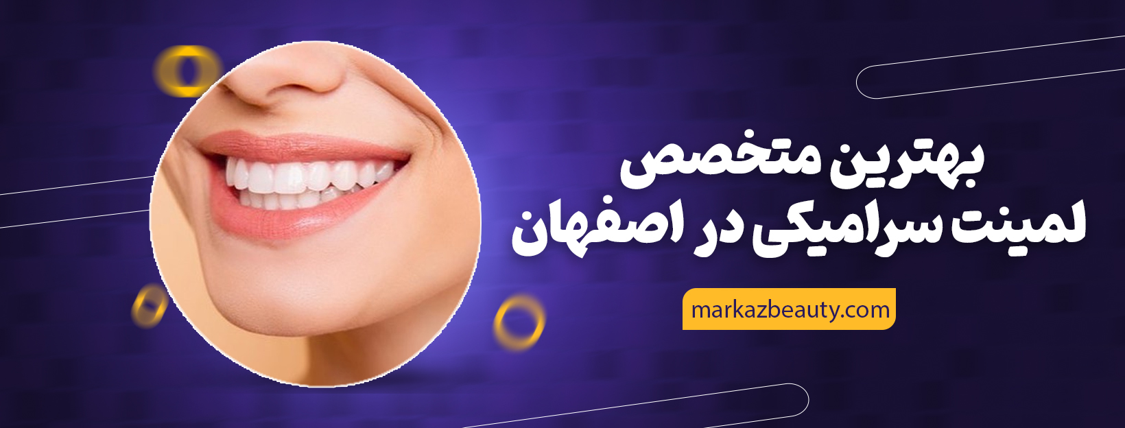 لمینیت سرامیکی در اصفهان 