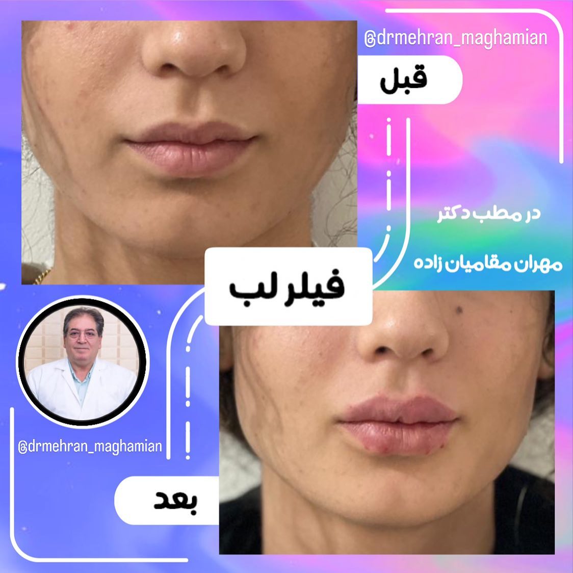 دکتر مهران مقامیان زاده پزشک میکرودرم| بهترین پزشک میکرودرم در تهران