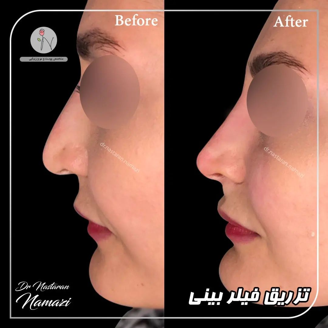 دکتر نسترن نمازی بهترین متخصص کربوکسی تراپی| بهترین پزشک کربوکسی تراپی در تهران