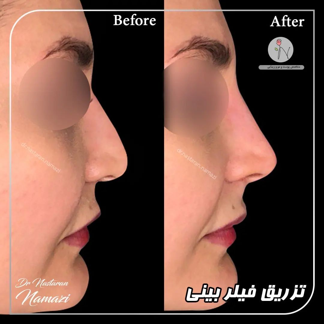 دکتر نسترن نمازی بهترین متخصص کربوکسی تراپی| بهترین دکتر کربوکسی تراپی در تهران