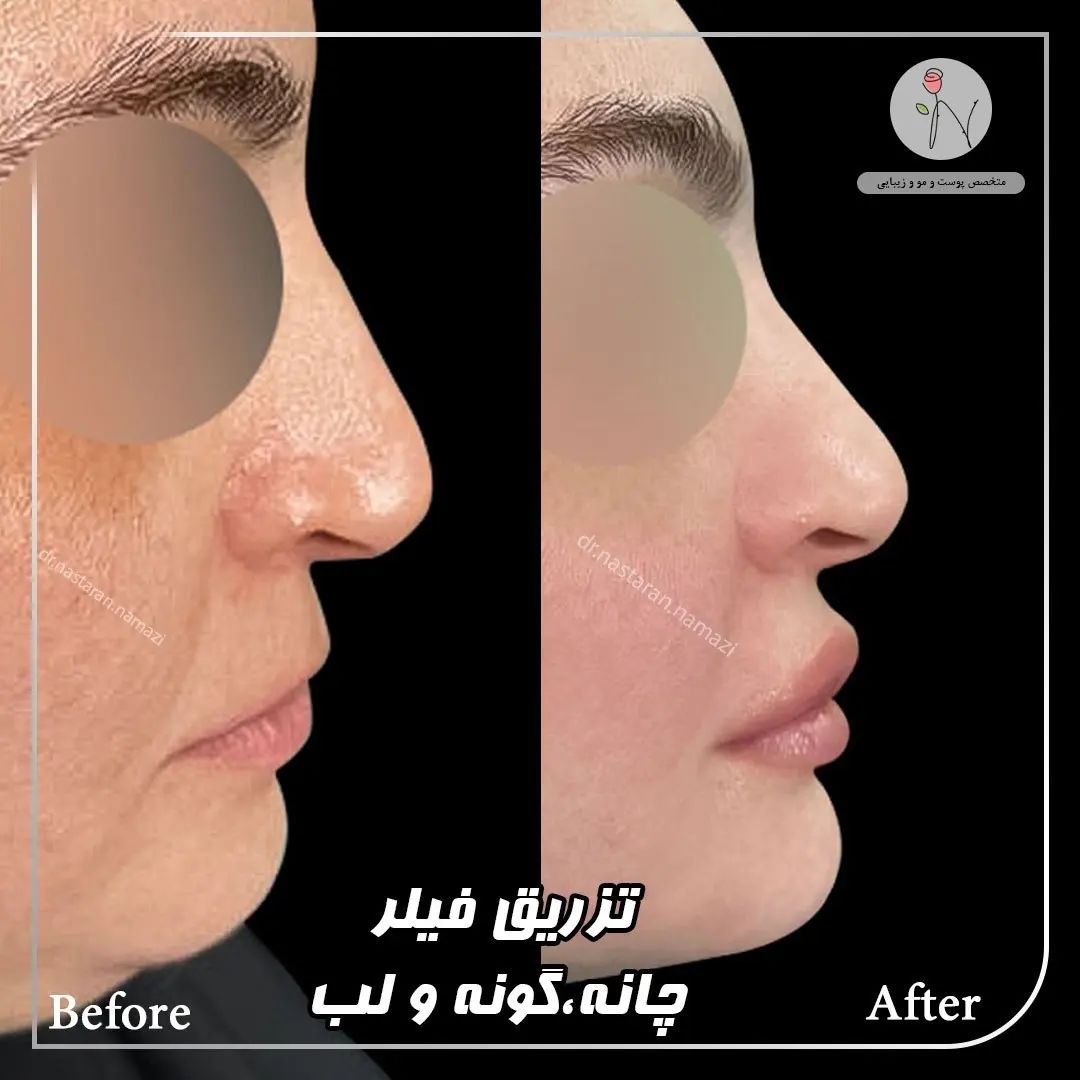 دکتر نسترن نمازی بهترین متخصص کربوکسی تراپی| بهترین دکتر کربوکسی تراپی در تهران