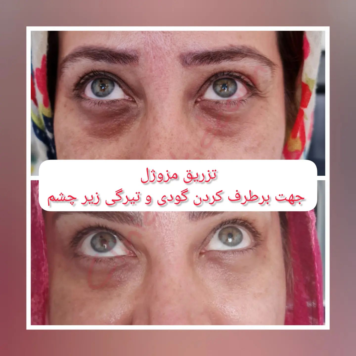 کلینیک تخصصی ارکید مرکز میکرودرم| بهترین کلینیک میکرودرم در تهران