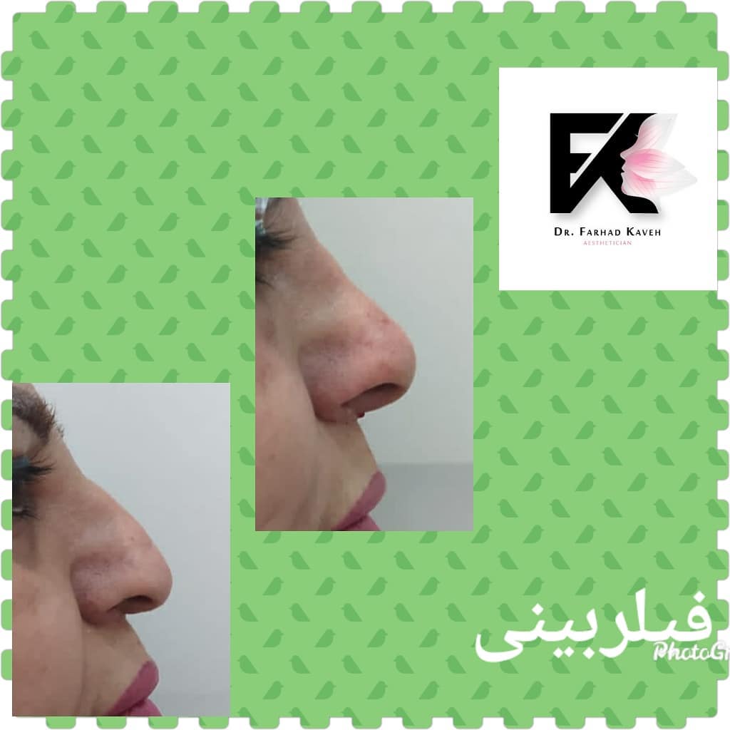 دکتر فرهاد کاوه بهترین متخصص کربوکسی تراپی در کرج| بهترین دکتر کربوکسی تراپی در کرج