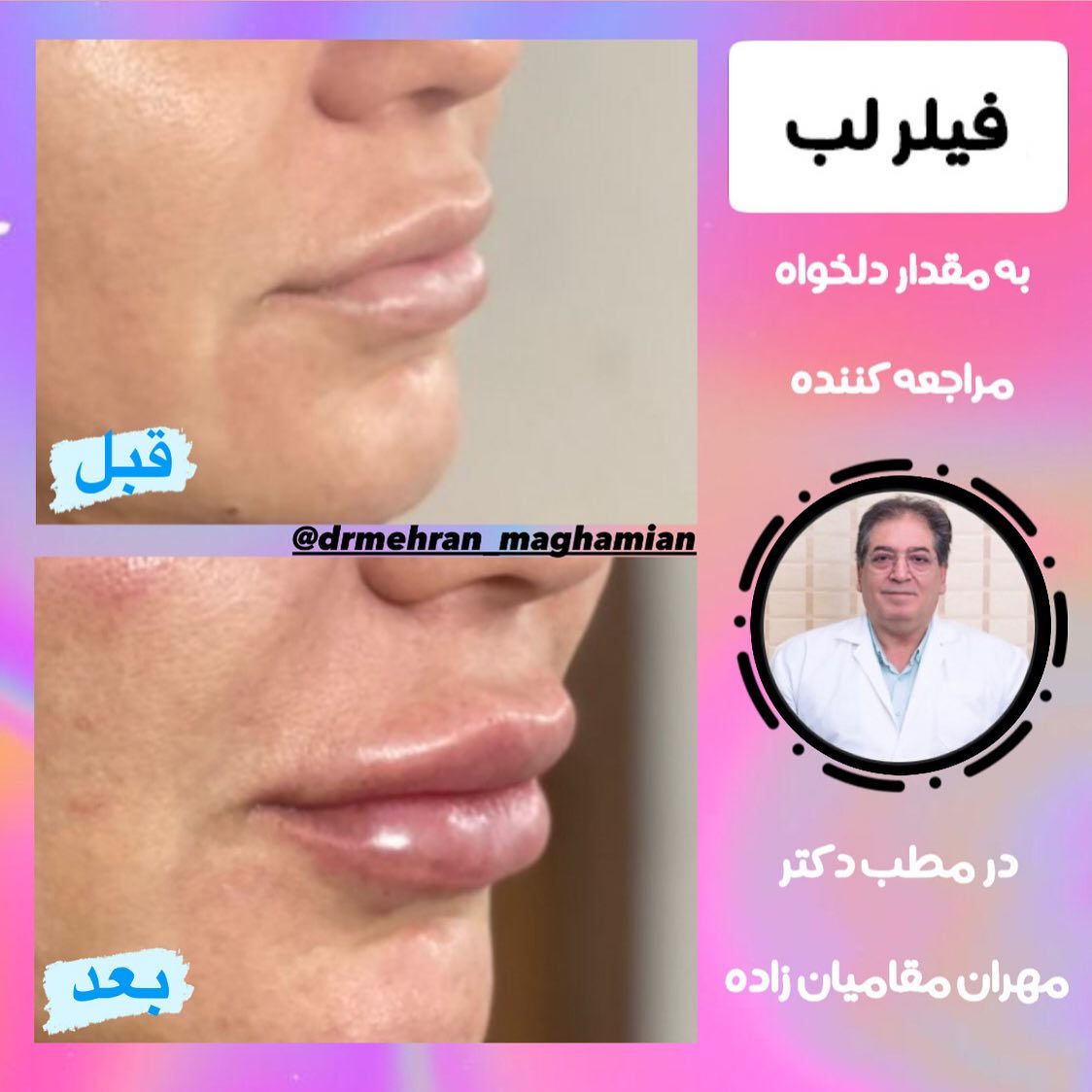 دکتر مهران مقامیان زاده پزشک میکرودرم| بهترین متخصص میکرودرم در تهران