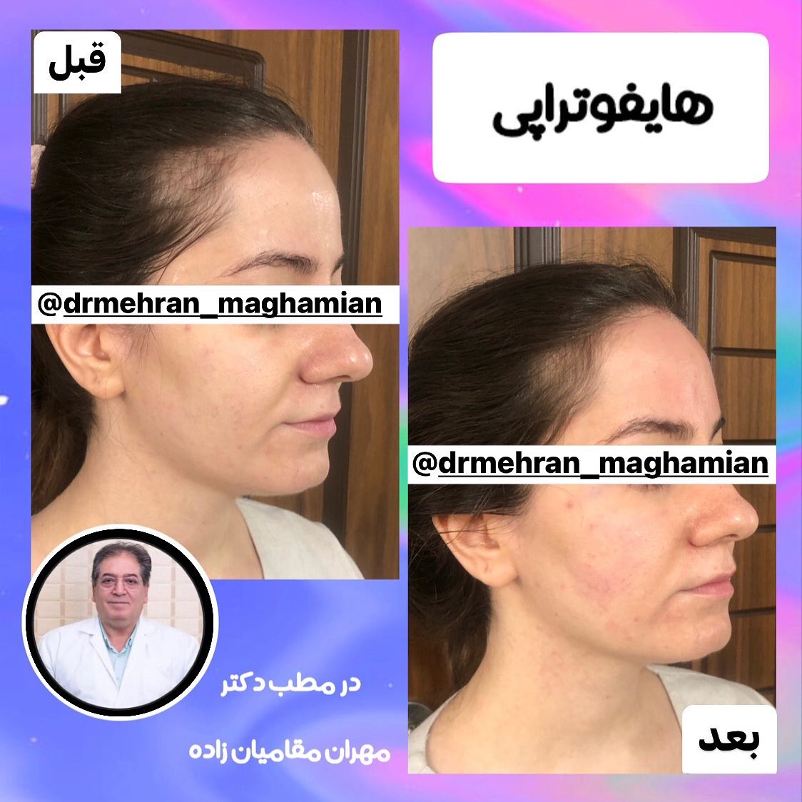 دکتر مهران مقامیان زاده دکتر میکرودرم| بهترین پزشک میکرودرم در تهران