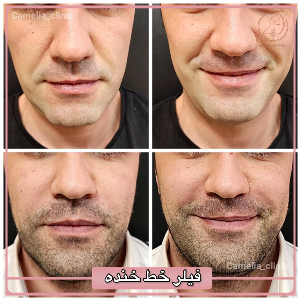مرکز تخصصی کاملیا بهترین مطب پیلینگ در کرج |بهترین کلینیک پیلینگ در کرج