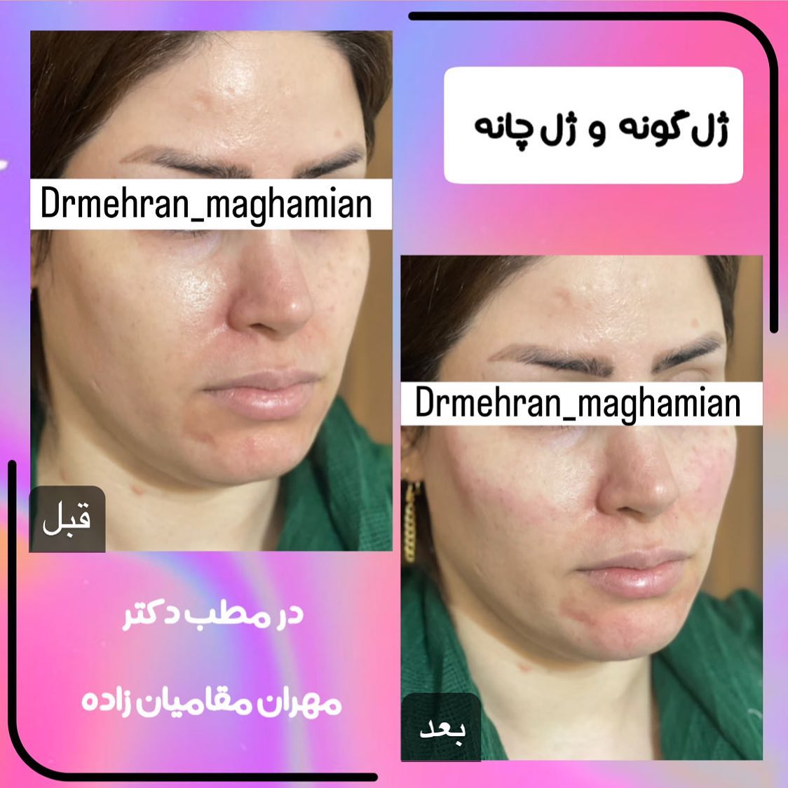 دکتر مهران مقامیان زاده پزشک میکرودرم| بهترین پزشک میکرودرم در تهران
